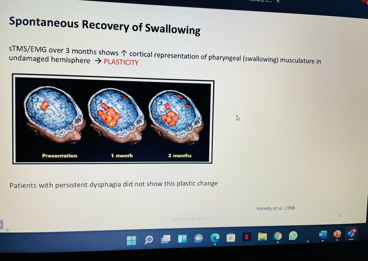 Thank you to Prof Smithard for his informative whistle stop tour of #dysphagia A perfect aperitif to #SwallowAwarenessDay this week and #nutitionandhydrationweek commencing tomorrow ‘treat the person not the condition’ <a href="/MedwaySLT/">MEDWAY SLT</a> <a href="/Swallowologist1/">Swallowologist</a>