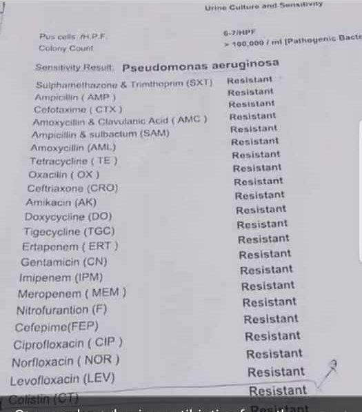 OAZIS Health (@oazishealth) on Twitter photo Imagine when U or Ur loved one get results like this, the bacteria here is resistant to all available #Antibiotics. Doctors can do nothing from here 😭😭😭
Here is why we need to act on #AntimicrobialResistance
<a href="/RBCRwanda/">Rwanda Biomedical Centre</a> <a href="/RwandaHealth/">Ministry of Health | Rwanda</a> <a href="/PARFoundation/">PA Research Foundation</a> Imagine when U or Ur loved one get results like this, the bacteria here is resistant to all available #Antibiotics. Doctors can do nothing from here 😭😭😭
Here is why we need to act on #AntimicrobialResistance
<a href="/RBCRwanda/">Rwanda Biomedical Centre</a> <a href="/RwandaHealth/">Ministry of Health | Rwanda</a> <a href="/PARFoundation/">PA Research Foundation</a>