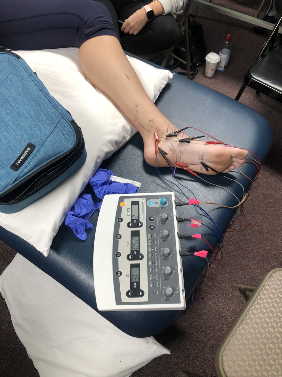 BenjaminEnglan5's tweet photo. DN-2 in Jacksonville, FL finishing strong with PT’s, DC’s, and AT’s from around the globe treating plantar fasciitis, knee osteoarthritis, and other LE conditions with multiple needles left in situ! #raiseyourgame with @osteopractor and the #AAMTFellowship https://t.co/g1WBMWUWVn