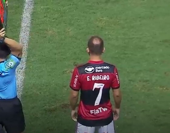 Everton Ribeiro revela em vídeo como se tornou 'ex-calvo