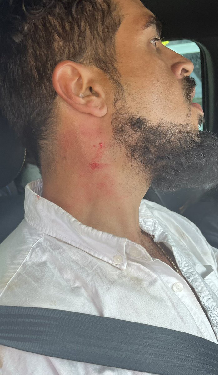 kenvowles's tweet photo. I’ll never walk past RACISM. My mum was treated differently because of the colour of her skin on 2 seperate occasions. HEARTBREAK HOTEL! We've reported you to the police &amp; we'll all be making statements today. You assaulted my brother as he was walking out &amp; then choking him! https://t.co/jEVLunQmvO