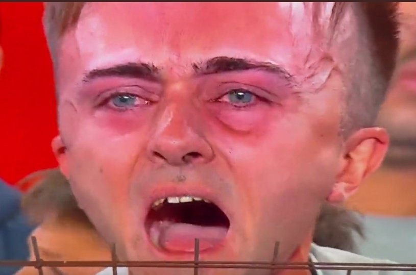 Cuando te das el dedo chiquito contra la pata del mueble