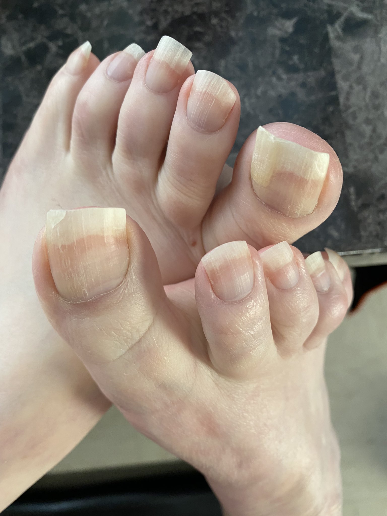 Natural Toes (@natural_toes) / X