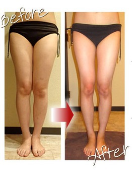 足痩せ Twitter Search Twitter