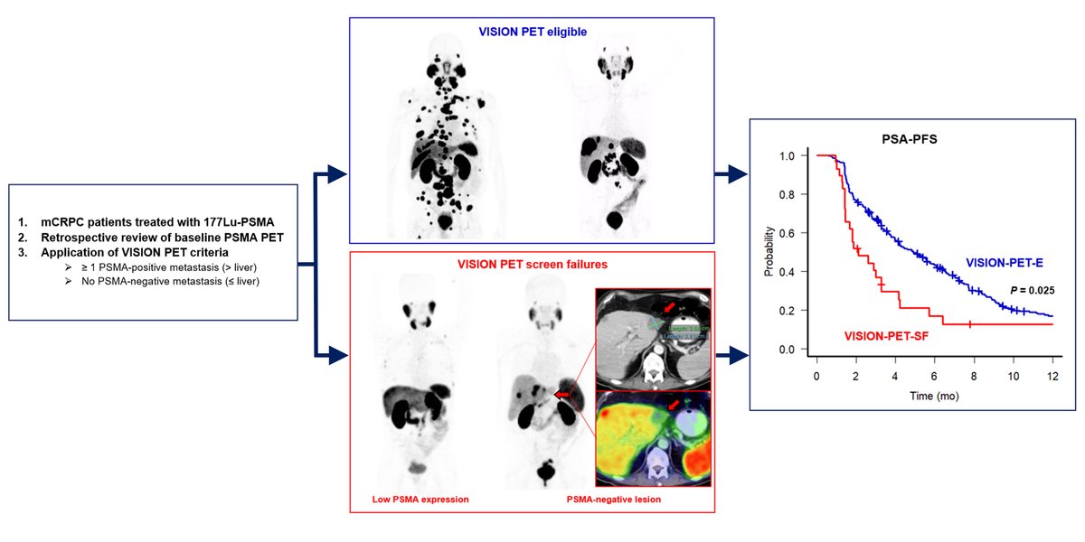 Patients who do not meet the #PSMA PET/CT eligibility criteria used in the #VISIONtrial and who are treated with #LutetiumPSMA do not respond well to treatment with a PSA50RR of 20%. #Biomarker #prostatecancer #theranostics #PETimaging
jnm.snmjournals.org/content/early/…