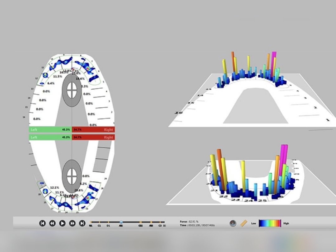 When it comes to TMD treatment, a healthy balance and position of the surrounding musculature, ligaments and joints is crucial for an optimal result. To ensure this we use advanced dental technology to accurately establish the ideal jaw position before we start treatment.
#dental
