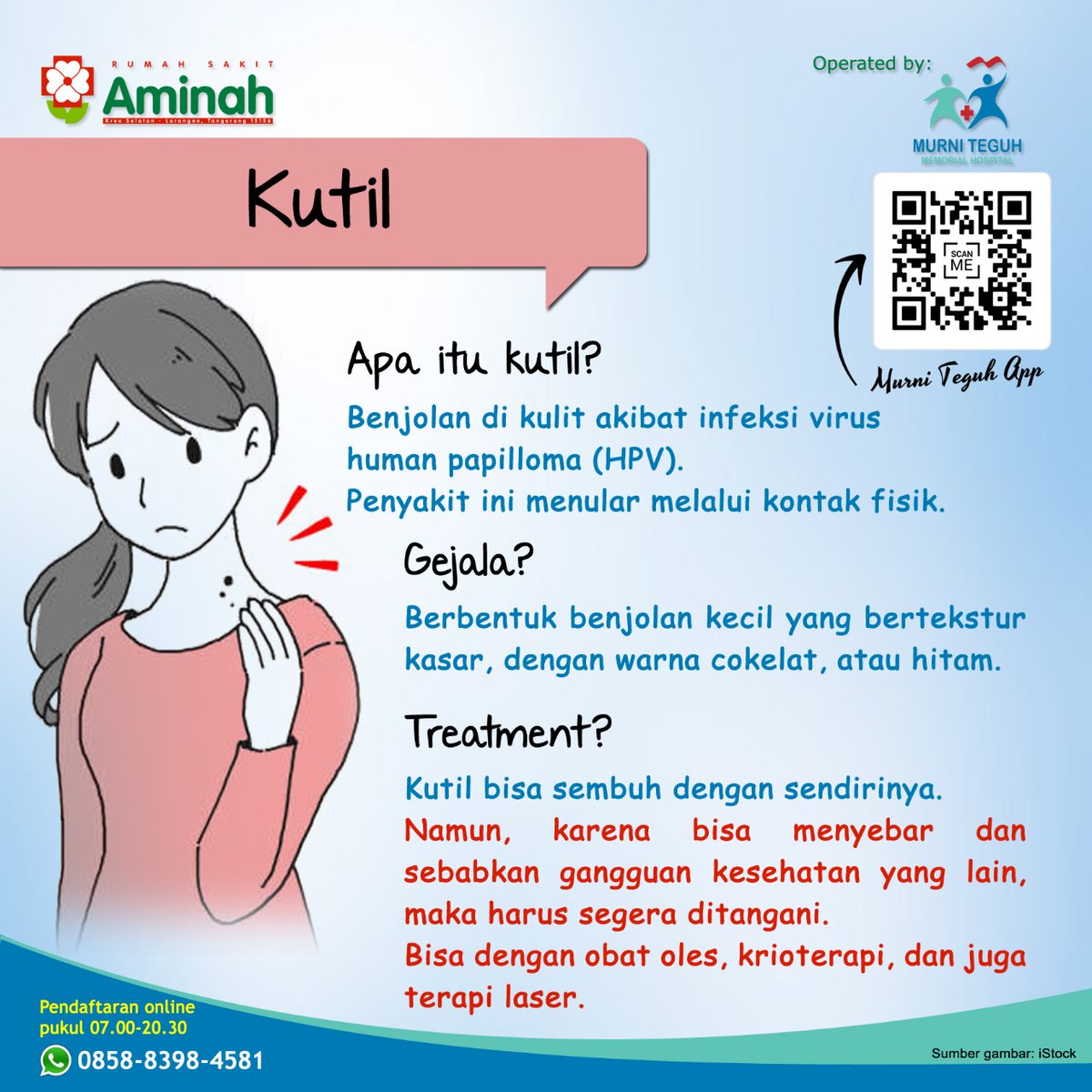 rsmurniteguhct's tweet photo. KUTIL !

Kutil disebabkan oleh infeksi virus human papilloma (HPV).
Penyakit ini menular.
Gejala nya berupa benjolan kecil yang bertekstur kasar dengan warna cokelat atau hitam.

Download aplikasi Murni Teguh :
https://t.co/MDbudsmhat

#Kutil 
#MurniTeguh https://t.co/fEGbdCMcKj