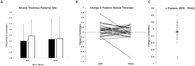 EJAP_official's tweet photo. Muscle growth adaptations to high-load training and low-load training with blood flow restriction in calf muscles.  @SamuelBuckner1 #BloodFlowRestriction #Muscle #ResistanceTraining https://t.co/UFe2zJN6K2 https://t.co/grTvPMIP5u
