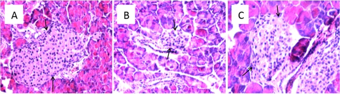 Exendin-4 may improve type 2 diabetes by modulating the epigenetic modifications of pancreatic histone H3 in STZ-induced diabetic C57BL/6 J mice  #diabetes #epigenetics #exendin #histone_H3 #PDX1  rdcu.be/cIe0E