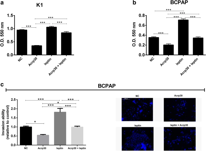Journal of Physiology and Biochemistry (@jpby_official) on Twitter photo Adiponectin and leptin exert antagonizing effects on proliferation and motility of papillary thyroid cancer cell lines <a href="/unicampania/">UniversitàVanvitelli</a> <a href="/Ceinge/">CEINGE-Biotecnologie Avanzate Franco Salvatore</a> <a href="/Uniparthenope/">Università degli Studi di Napoli "Parthenope"</a> <a href="/UninaIT/">Unina Federico II</a> #adiponectin #leptin #proliferation #motility #thyroid #cancer #openaccess
link.springer.com/article/10.100… Adiponectin and leptin exert antagonizing effects on proliferation and motility of papillary thyroid cancer cell lines <a href="/unicampania/">UniversitàVanvitelli</a> <a href="/Ceinge/">CEINGE-Biotecnologie Avanzate Franco Salvatore</a> <a href="/Uniparthenope/">Università degli Studi di Napoli "Parthenope"</a> <a href="/UninaIT/">Unina Federico II</a> #adiponectin #leptin #proliferation #motility #thyroid #cancer #openaccess
link.springer.com/article/10.100…