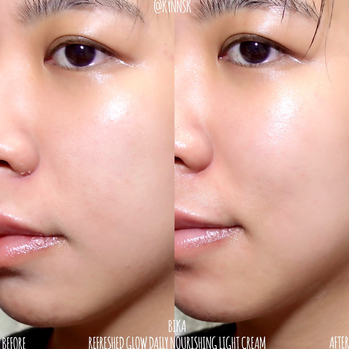 kynnsk's tweet photo. เป็น moisturizer ที่อยากให้ทุกคนมีติดบ้านจริงๆ ที่ผิวแห้งลอกจากการใส่แมส แถมสิวและรอยแดง ผื่นแดงก็ขึ้น แต่พอใช้ BIKA Refreshed Glow Daily Nourished Light Cream แล้วผิวดีขึ้น เค้าช่วยเพิ่มความชุ่มชื้นและฟื้นฟูผิวให้กลับมาสุขภาพดี ✨ https://t.co/BeUrjvJsUC