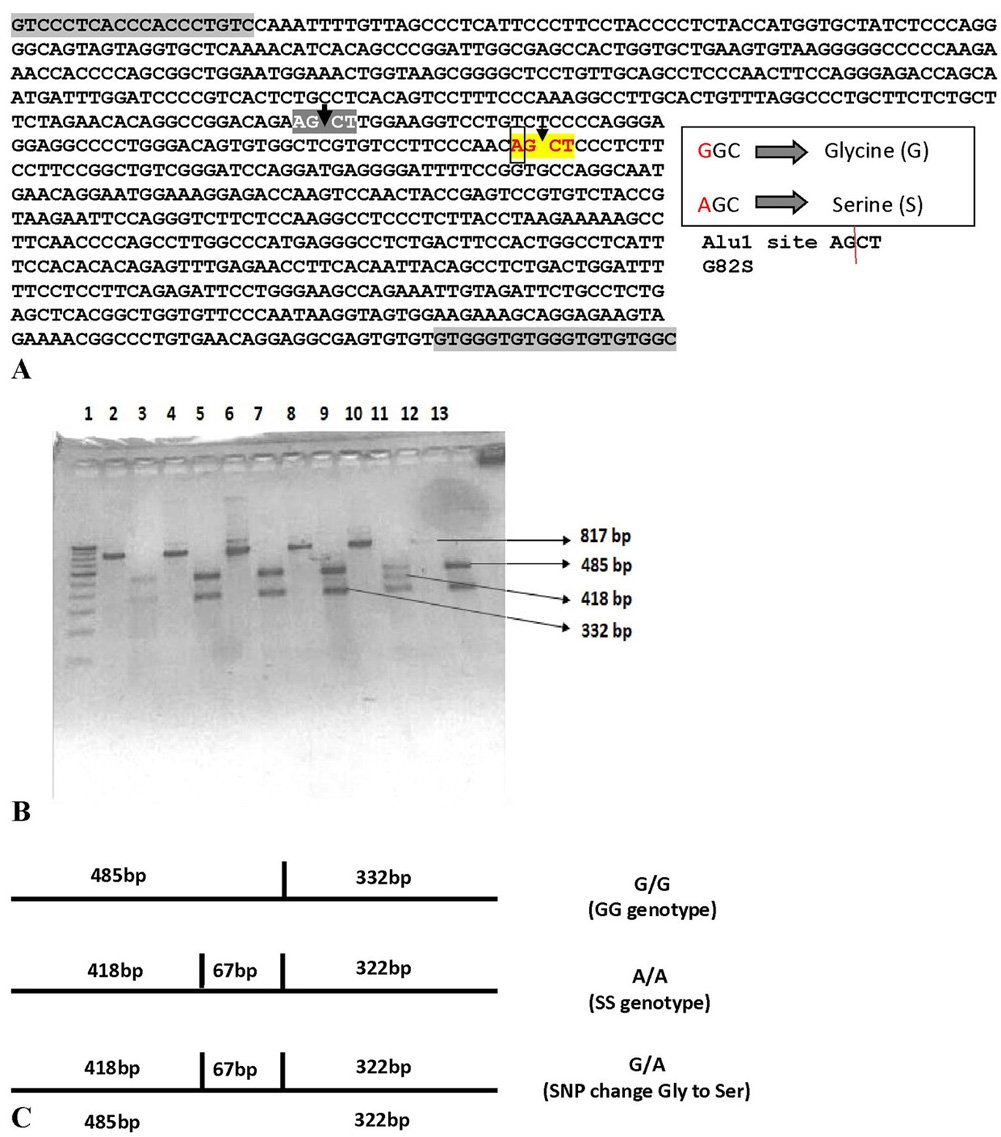 Elite_IMR's tweet photo. Welcome to read👇
G82S RAGE #polymorphism is associated with #Alzheimer���s disease
🔗https://t.co/iZIUnWUAAv
#RAGE #AD #sRAGE #genotype #FBE https://t.co/XEYFaqMk2W