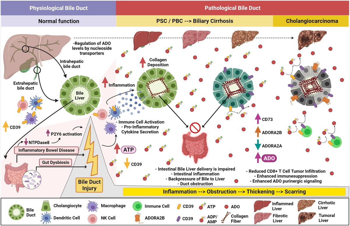 DuctalvsAcinar's tweet photo. Happy to share this review on nucleotide and adenosine signaling in biliary and pancreatic #inflammation & #cancer written with Drs. Faraoni @erifaraoni, Ju, Eltzschig and @SimonCRobson. Thanks to editors @LuhtalaNatalie and @DelgiornoKathy @FrontPhysiol
https://t.co/Q2pyQLI4Sx https://t.co/wg9uWrXxwC
