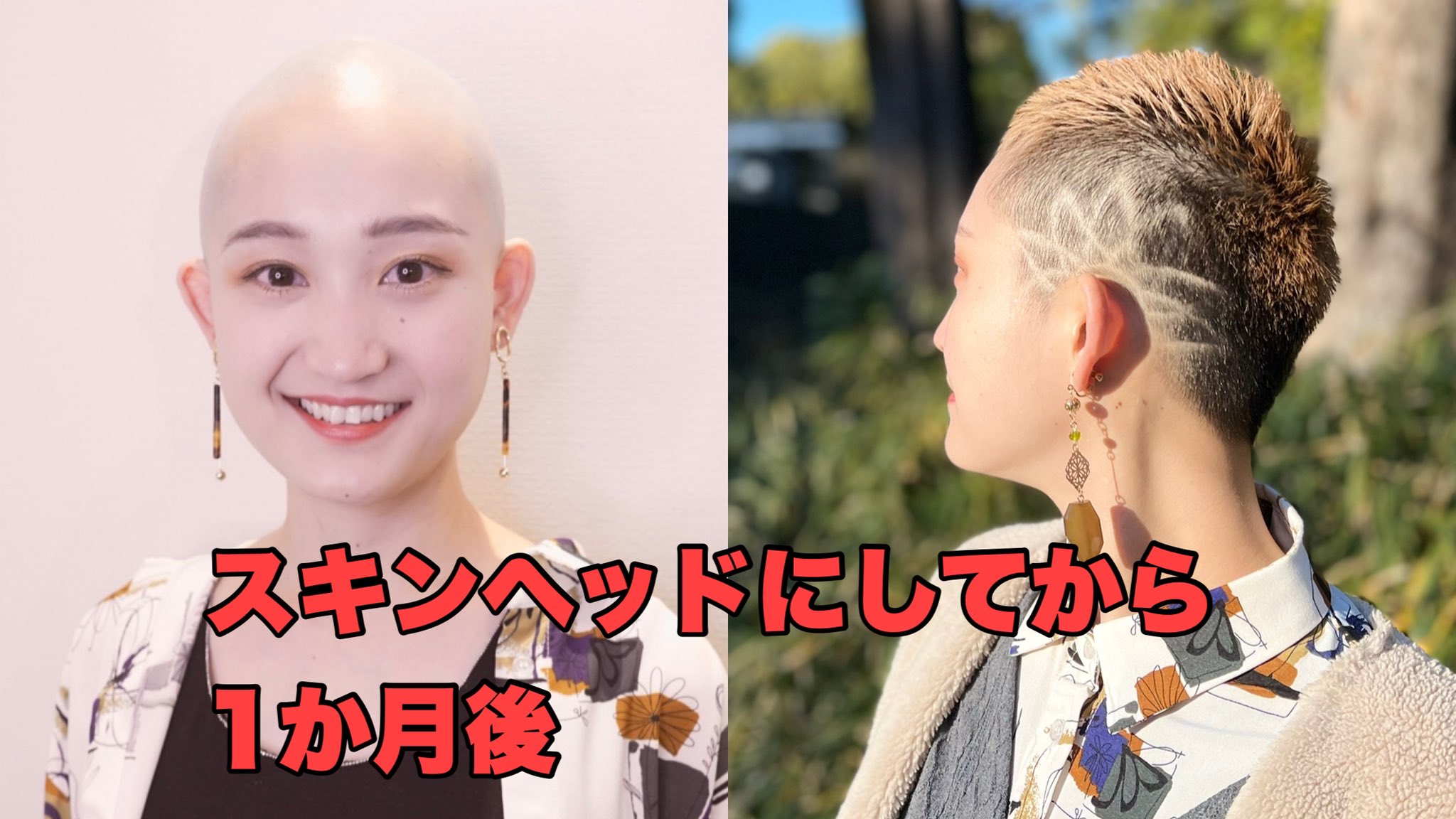 ばしし 撮影カットモデル様募集中 都内 カット代無料 モデル代お支払い ヘアドネーション対応 Di Twitter ツルツルのスキンヘッドにしてから１月後 頭を刈りこんで大きなバリアートをいれました Youtube公開中 T Co Jpmjm2dybt Youtubeより 女坊主