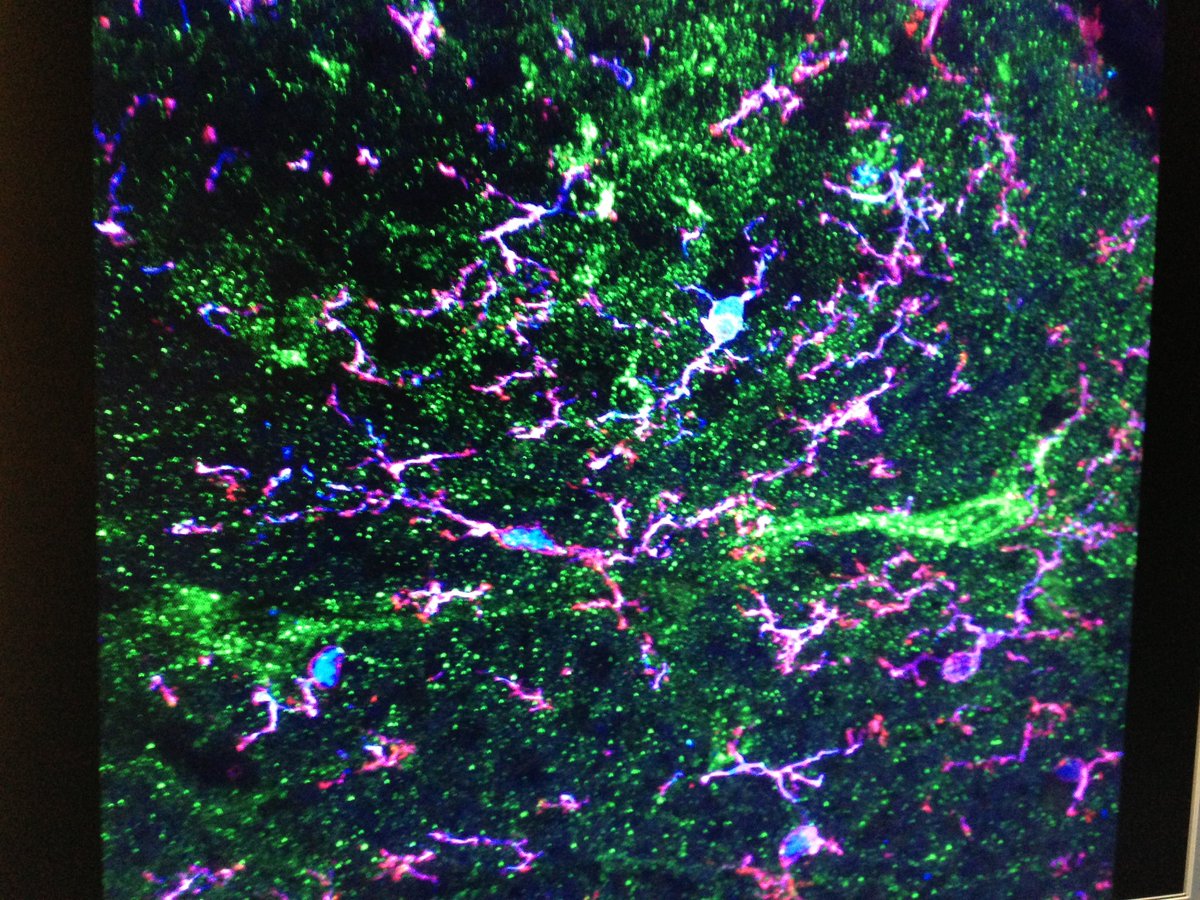 Let’s start calling neurons “non-glial” cells