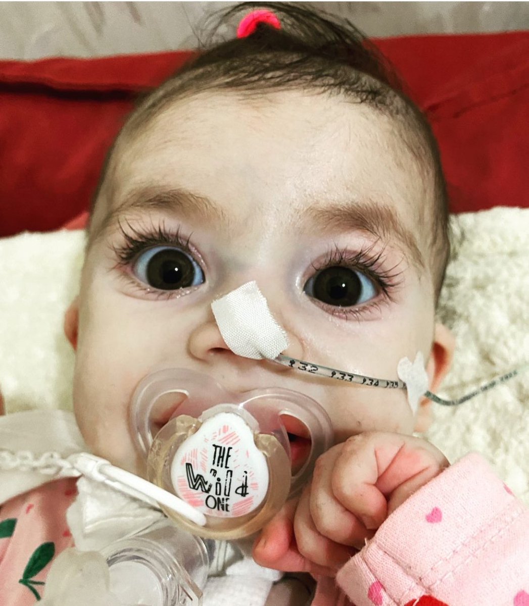 Boncuk gözlü Eslem Fatma sizlere böyle boncuk boncuk bakiyoo ve yardım istiyor .Gözleri umut dolu sizlerde o umut dolu gözlerine sevinç katmak istemezmisiniz ?🍓🍓🍓