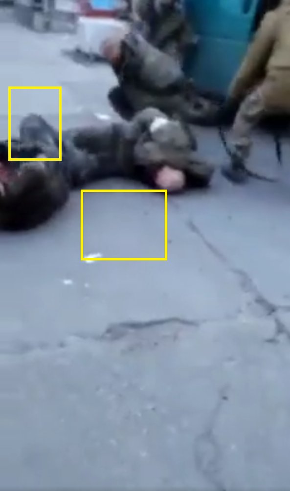 The recent video posted by a russian propagandist is "concerning".There are issues with what is shown, mainly related with the alleged wounds.In the short vid, it's obvious that there is NO marks of any shooting in the right leg and no blood on the ground.  #ActorStudio1/3