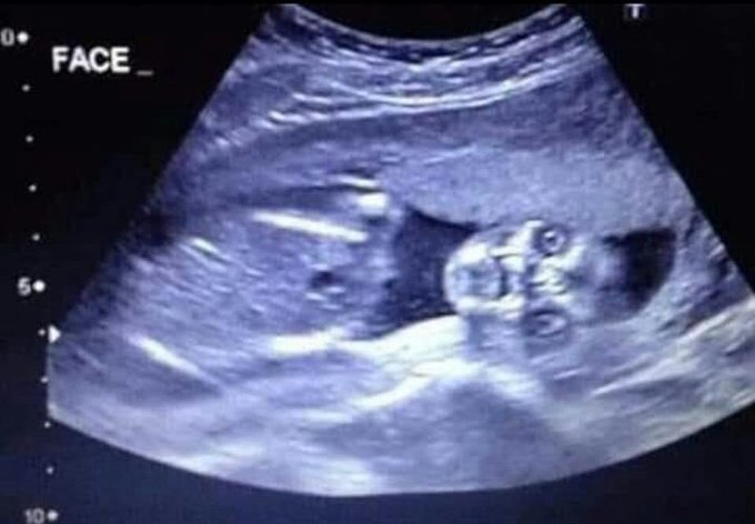 PadreGerardWay's tweet photo. #TBT de quando vimos o rostinho de minha sobrinha Jurubeba pela primeira vez ❤️ https://t.co/jszyDWfen1