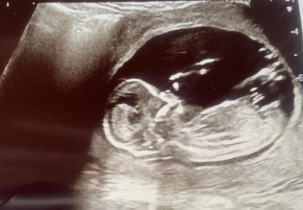 Steve Gleed tweet media