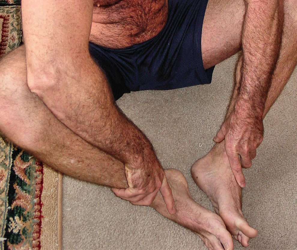 Hairy Legs Muscledaddy from https://t.co/oAwhABJ0gw view his only fans for daily nudist posts of him