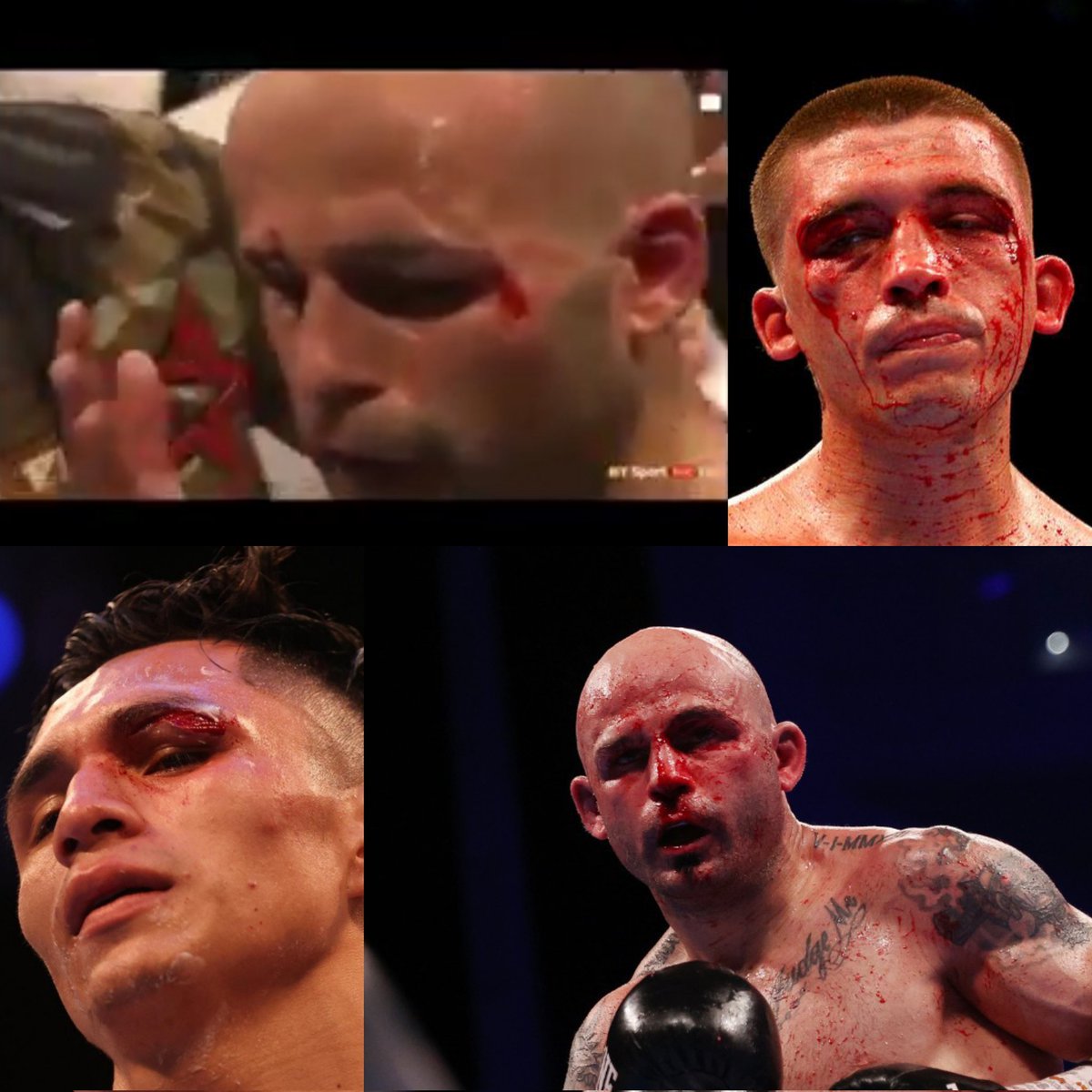BravidoLera's tweet image. Estos son algunos de los últimos rivales de Warrington. La imagen habla por sí sola. (La primera imagen es del primer combate, donde también se lleva cabezazos y codazos). 
Le quitarán algún día un punto? Hasta la fecha no ha ocurrido