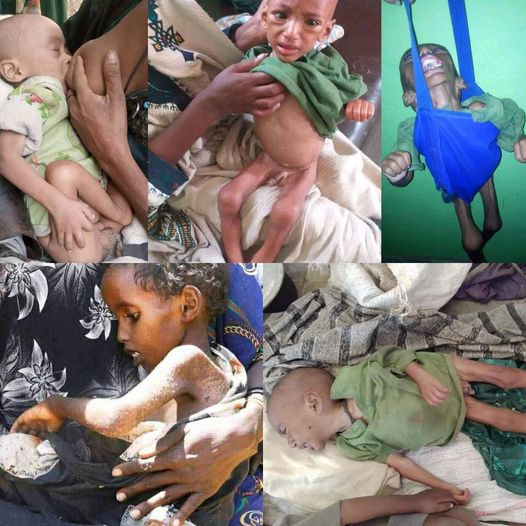AdmassuTsegaye's tweet photo. These are Agaw people in Ethiopia Tigray boarder dying of man made famine. They can not access humanitarian aid because they are in complete siege  by the Ethiopian government. https://t.co/0jmQMtsOH8