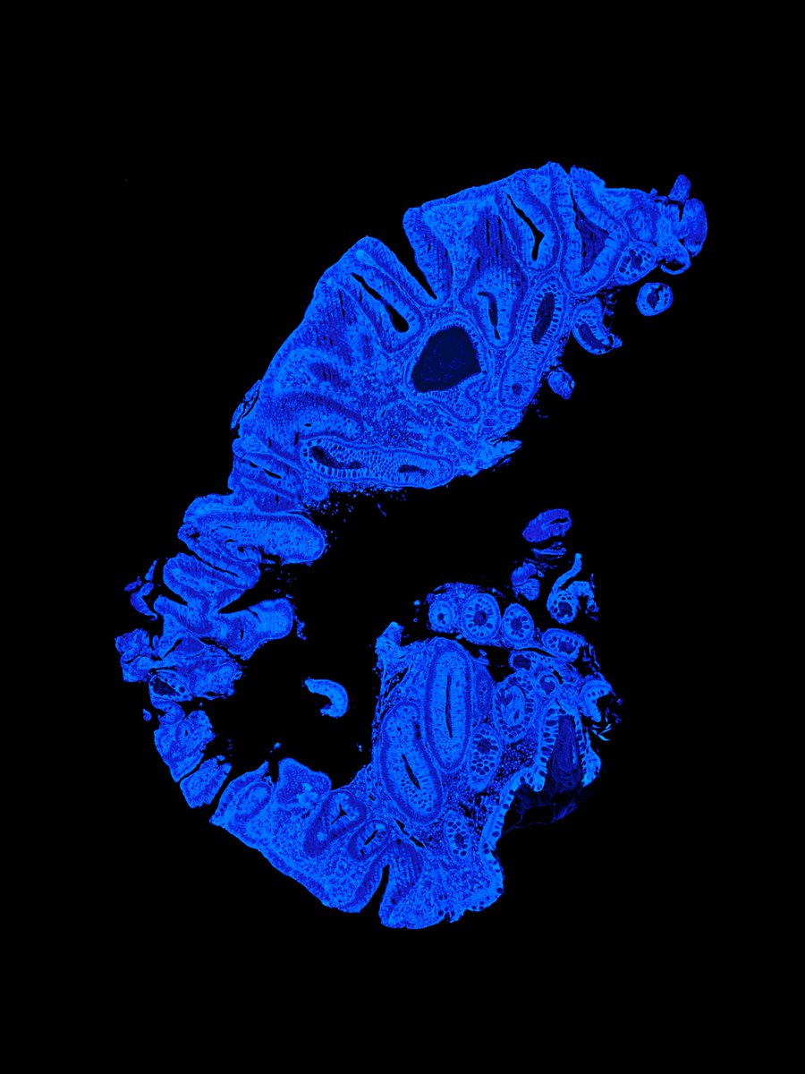 Image by Daniel Han
FluoreSlides: Colon Mucosa
Microscope: Olympus AX70
Light source: Lumencor Mira
Filter sets: #UVAutofluorescence with #OptolongDAPI filters (EX: 365nm/50nm, DM: 405nm, EM: 445/50nm) 
#olympuslifescience #microscopy #Cytometry #FlowCytometry #FlowCyto #FlowEDU