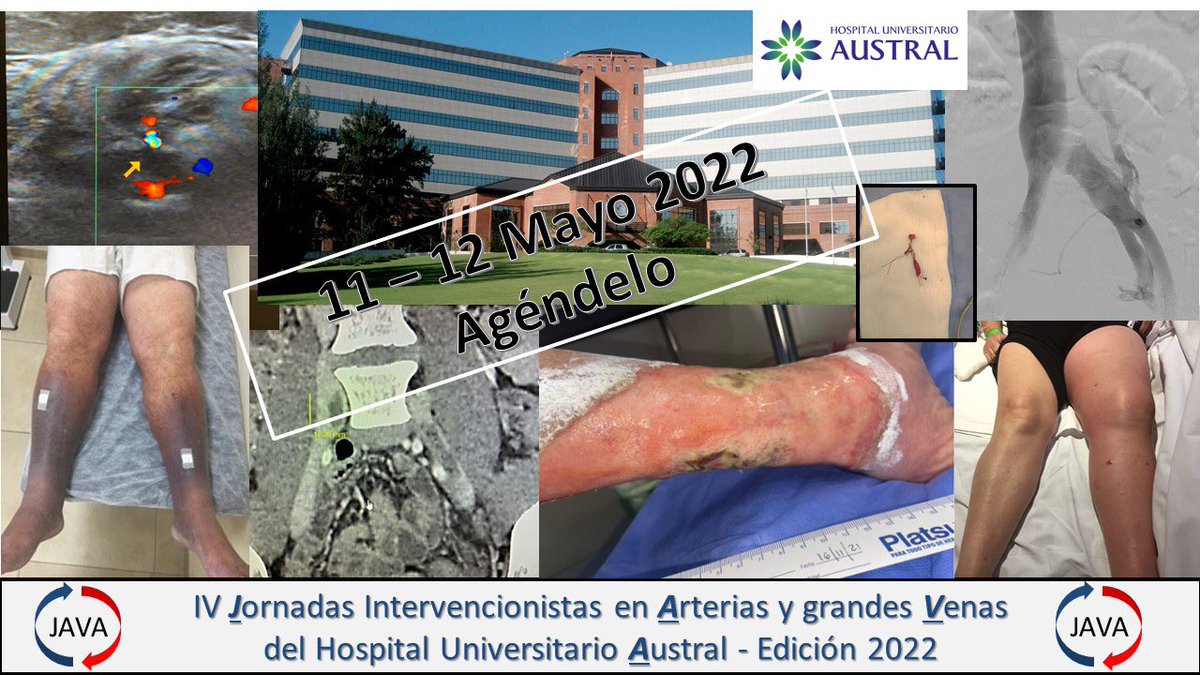 CostantiniRicar's tweet photo. @jmtelayna @sofikrause @HospitalAustral @CACIarg @hemodinamiasac https://t.co/vj4xIHiQTa