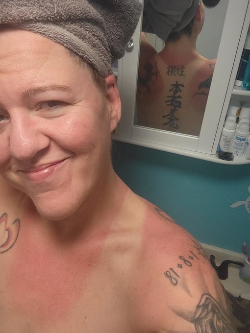 I may have done a little too much yard work today. Ouch 🥵 https://t.co/iOTNQf8Qdx<a href="/tag/mvsales"class="tags"><span>#mvsales</span></a>