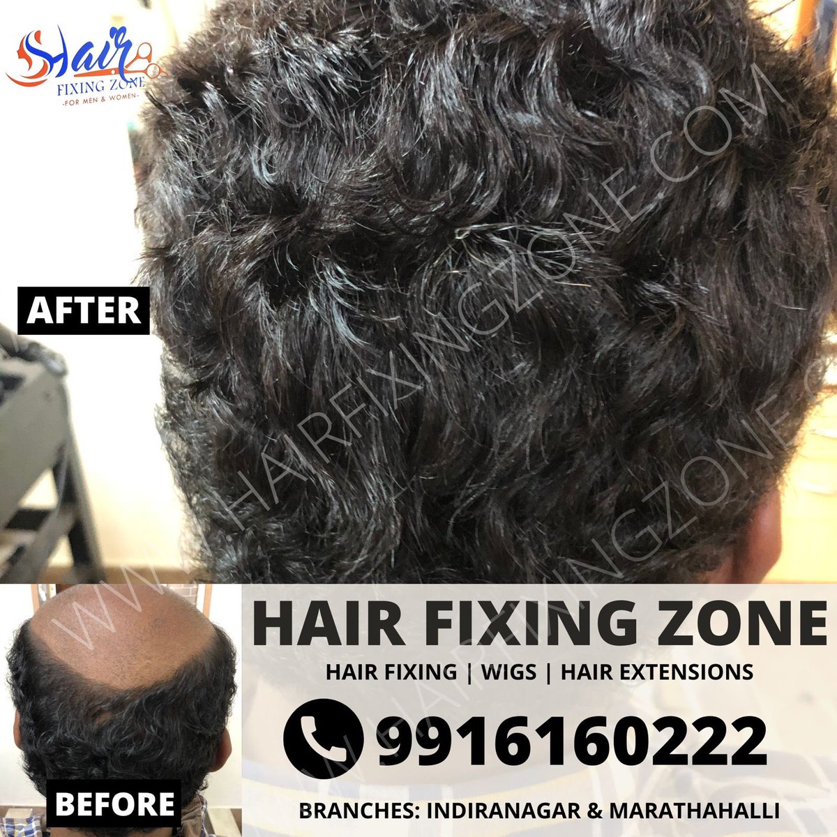 HAIRFIXINGZONE's tweet photo. #HAIRFIXINGZONE-:
Are you experiencing #hairloss or #patternbaldness? Don't worry, we are here to help you to get a new look in 1 hour through #Non_SurgicalHairReplacement.
Feel free to contact us!!
We are happy to assist you.
Call@9916160222
Web- https://t.co/SRlMjs683Z https://t.co/WS7vtVtqNl