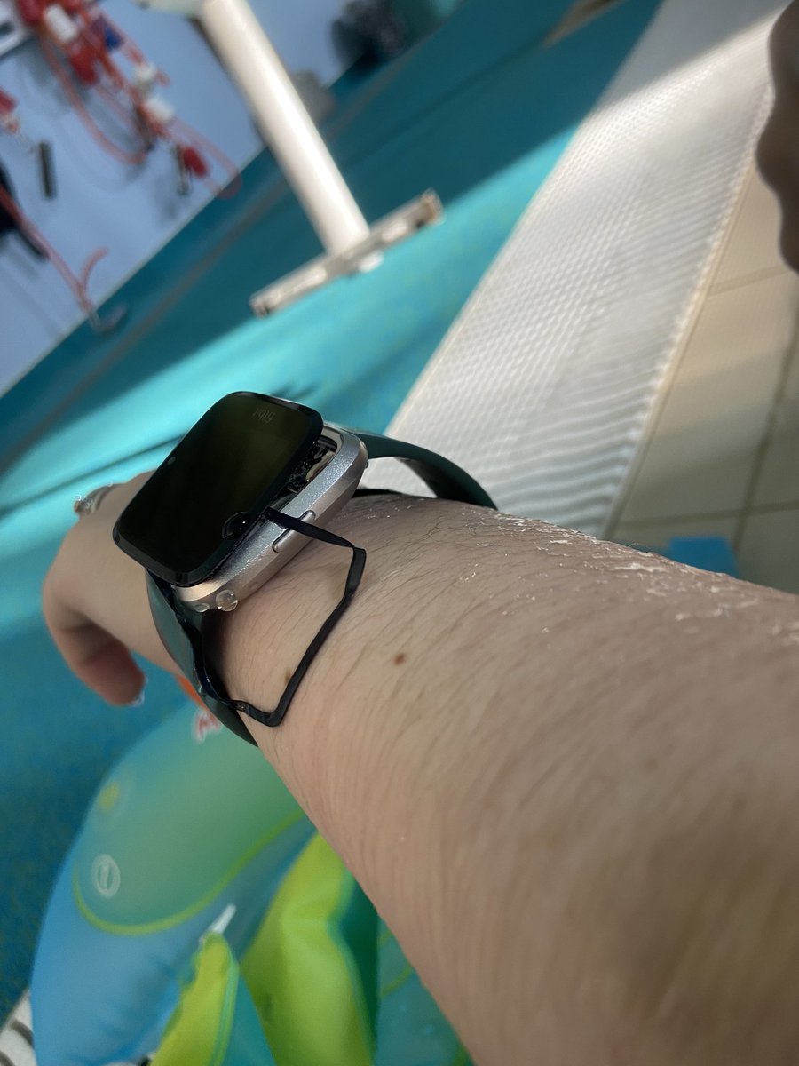 laurraa90's tweet photo. @FitbitSupport help, why did this happen to my Fitbit?! Only had it a couple of years so surely they shouldn’t break that quickly?! https://t.co/DdmOKgDkJt