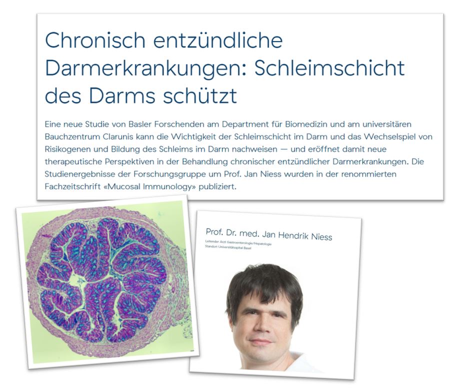 Clarunis Basel (@clarunis) on Twitter photo Die Studienergebnisse der Forschungsgruppe lassen auf einen möglichen neuen Behandlungsansatz für chronisch entzündliche Darmerkrankungen hoffen. lnkd.in/eK_QRPQY #Forschung #CED #MorbusCrohn #Colitisulcerosa #Basel <a href="/MucosalImmunol/">Mucosal Immunology</a> Die Studienergebnisse der Forschungsgruppe lassen auf einen möglichen neuen Behandlungsansatz für chronisch entzündliche Darmerkrankungen hoffen. lnkd.in/eK_QRPQY #Forschung #CED #MorbusCrohn #Colitisulcerosa #Basel <a href="/MucosalImmunol/">Mucosal Immunology</a>