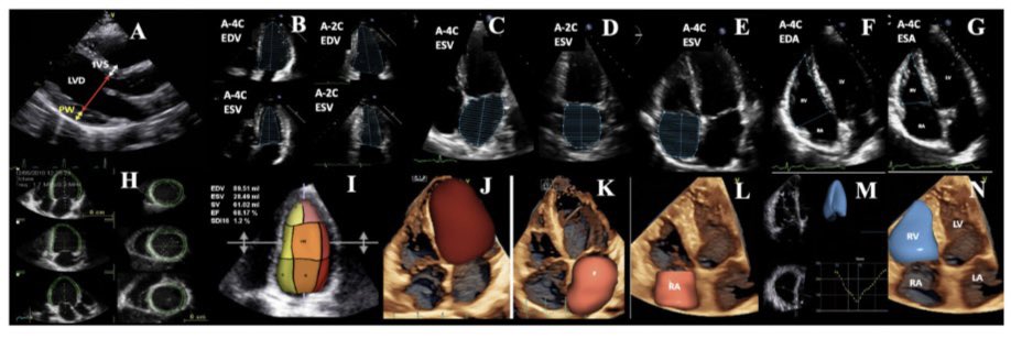 italian_cot's tweet image. 🫀💡Practically, the evaluation of valvular regurgitation requires the use of different imaging modalities 📷🧠

#cardiology #multimodalityimaging.  #cardioimaging #cardiologyfellow #cardiologia #echocardiography #ECG #cardiovascular #electrocardiography #cardiac #ITcardiology