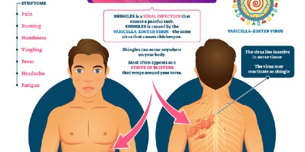 BristolUni's tweet photo. Patients aged 50 or older with newly diagnosed #shingles are wanted for a new study and one of the largest trials of its type in the world led by @riddmj @capcbristol to see if the pain which commonly persists after the rash has healed can be prevented.
👉https://t.co/MCooWDzlpl https://t.co/iTuJpt13Nm