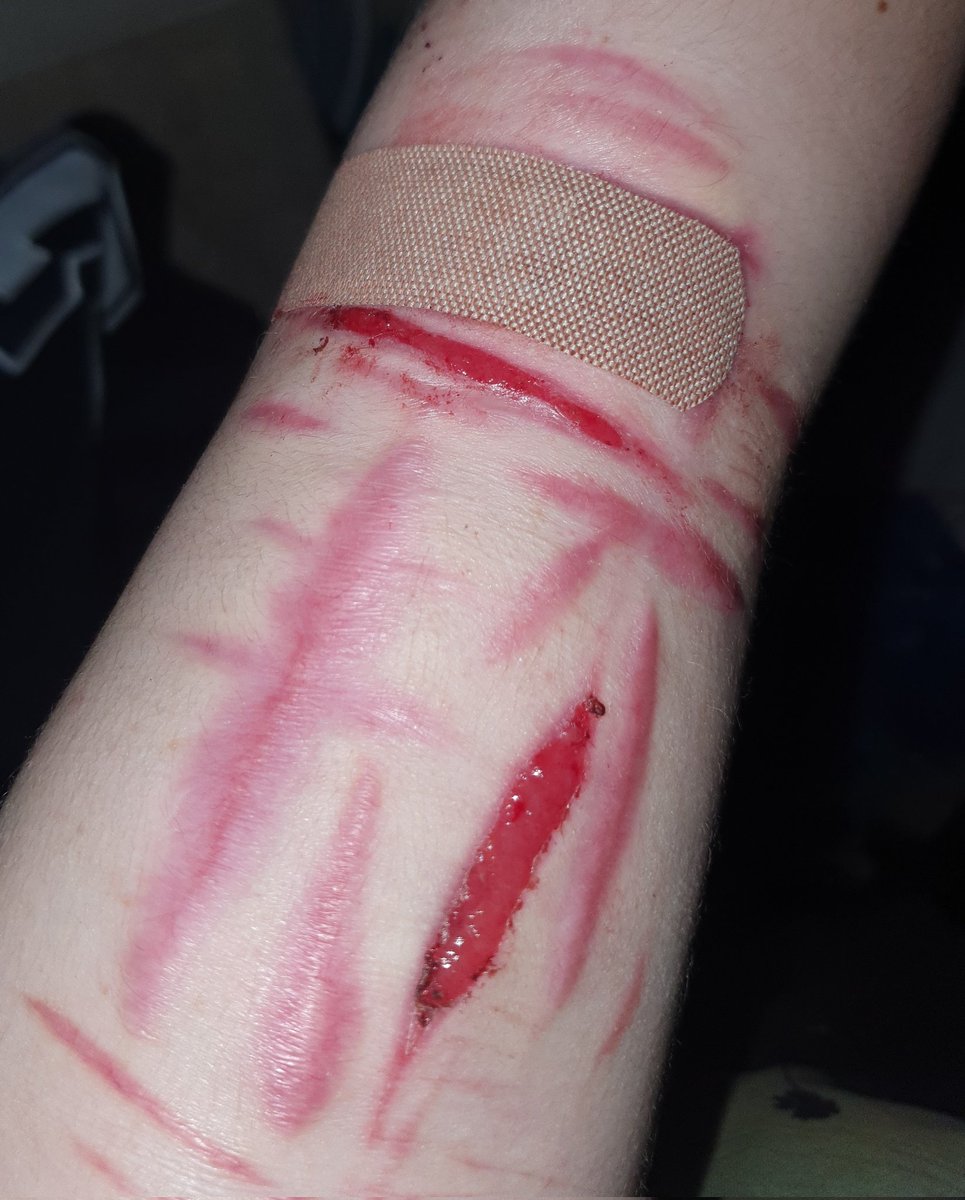 lavalampbl00d's tweet photo. idk I just find it funny to ignore after c4re and just put one band-a1d on beans kvts.
-
-
beanstwt barcodetwt yeettwt sliceytwt catscratchtwt armgillstwt ouchietwt styrotwt https://t.co/FAPwqntnF7