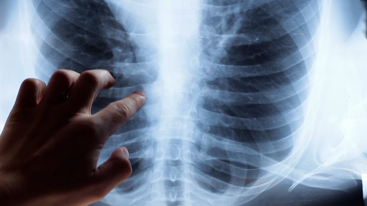 Global Health TV tweet media