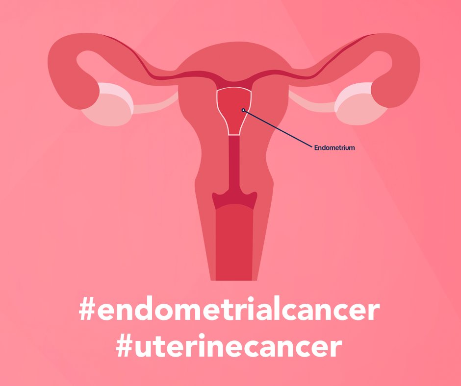 Endometrial cancer has been on the rise. People who are older and living with obesity are more likely to be diagnosed with this condition.
👉 Endometrial cancer may be detected and treated early
⬇️ Find out more ⬇️
ow.ly/iKqA50Iu6qU
#endometrialcancer #uterinecancer