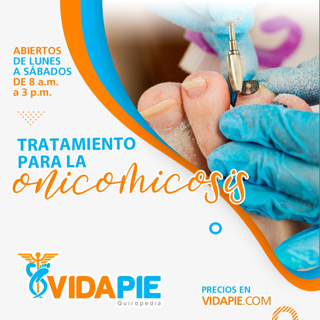 La onicomicosis es la alteración producida por la invasión de hongos patógenos o saprofitos en la estructura ungueal de #manos y/o #pies. Es la principal causa de enfermedad de la #uña en los países desarrollados.