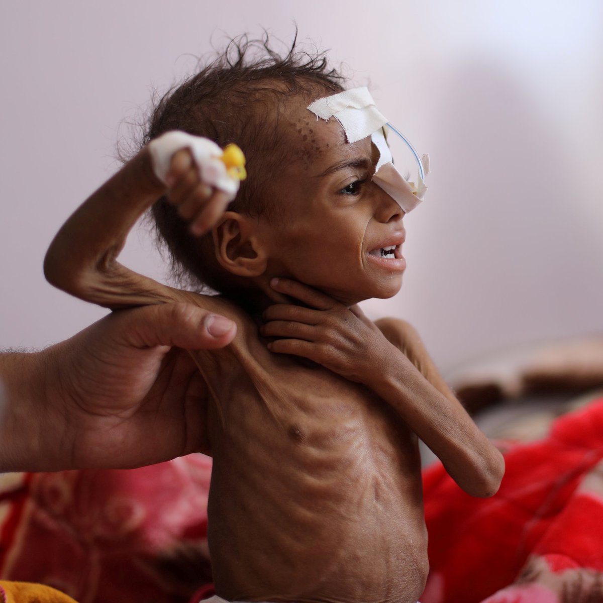 ajplus's tweet photo. Saudi-led coalition strikes killed at least 5 children in Yemen in retaliation for rebel strikes on a Saudi oil facility.

10,000+ children have been killed or wounded since the conflict began, with two-thirds the population (20 million people) suffering hunger and malnutrition. https://t.co/JrBgwIXqwY