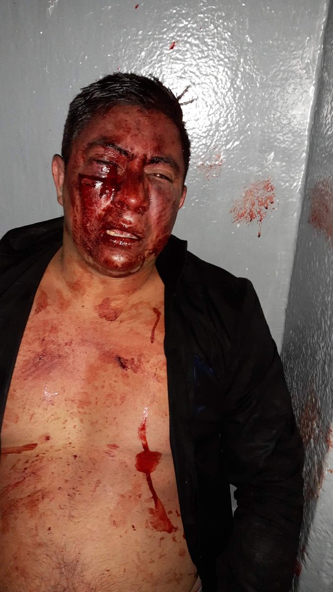 witter_leon70's tweet photo. @lopezobrador_ fueron agredidos por policías en la Venustiano Carranza junto con una mujer y un menos de edad!! https://t.co/04aiL6Lmxm