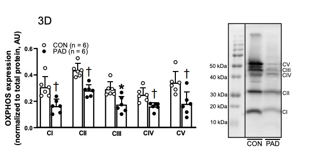 ajpheartcirc's tweet photo. #ArticlesInPress: Impaired #microcirculatory function, #mitochondrial respiration, and oxygen utilization in skeletal muscle of claudicating patients with peripheral artery disease
(Park et al.)
https://t.co/Pohh1LtOVd
@DrParasKMishra @unmc
#chronicischemia https://t.co/Kd6K1RCLB3