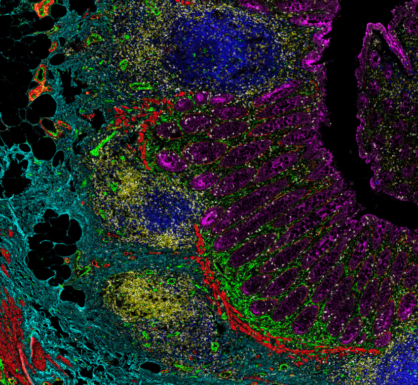 Standard_BioT's tweet photo. Think you know the power of #ImagingMassCytometry? Take a look at our new IMC™ page to see how this #spatialbiology tool is answering important translational and clinical research questions in the context of disease.

Check it out! https://t.co/195FXUCxfO

#highplex #imaging https://t.co/RfSW5tiJGS