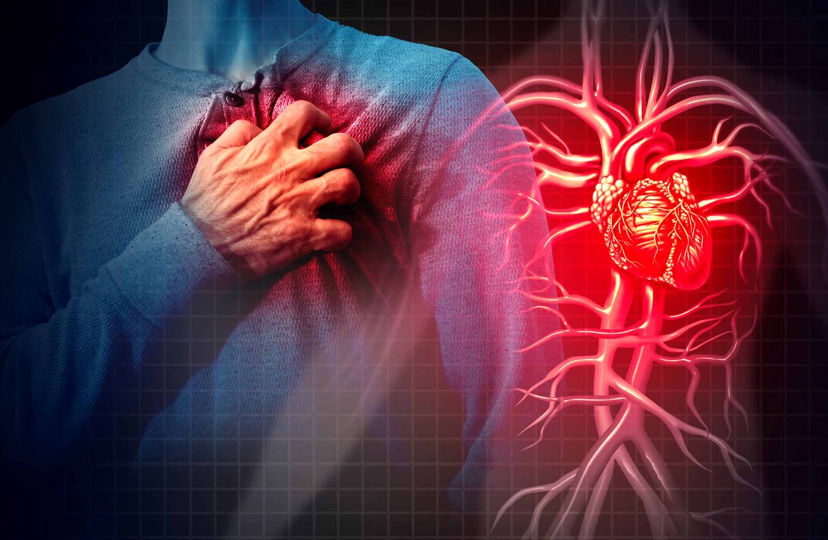 CCRadovic2012's tweet image. ADIÓS CORONAVIRUS, BIENVENIDOS INFARTOS – #DocFiles #DrFile #DoctorFile shar.es/aWVpAq