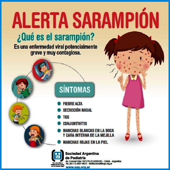 soc_arg_ped's tweet photo. El sarampión es una enfermedad altamente contagiosa que se disemina rápida y fácilmente de persona a persona. 
El Ministerio de Salud de la Nación emitió una alerta con el objetivo de informar y sensibilizar a la población ante la posible importación de casos. https://t.co/WAKaDlFwz6