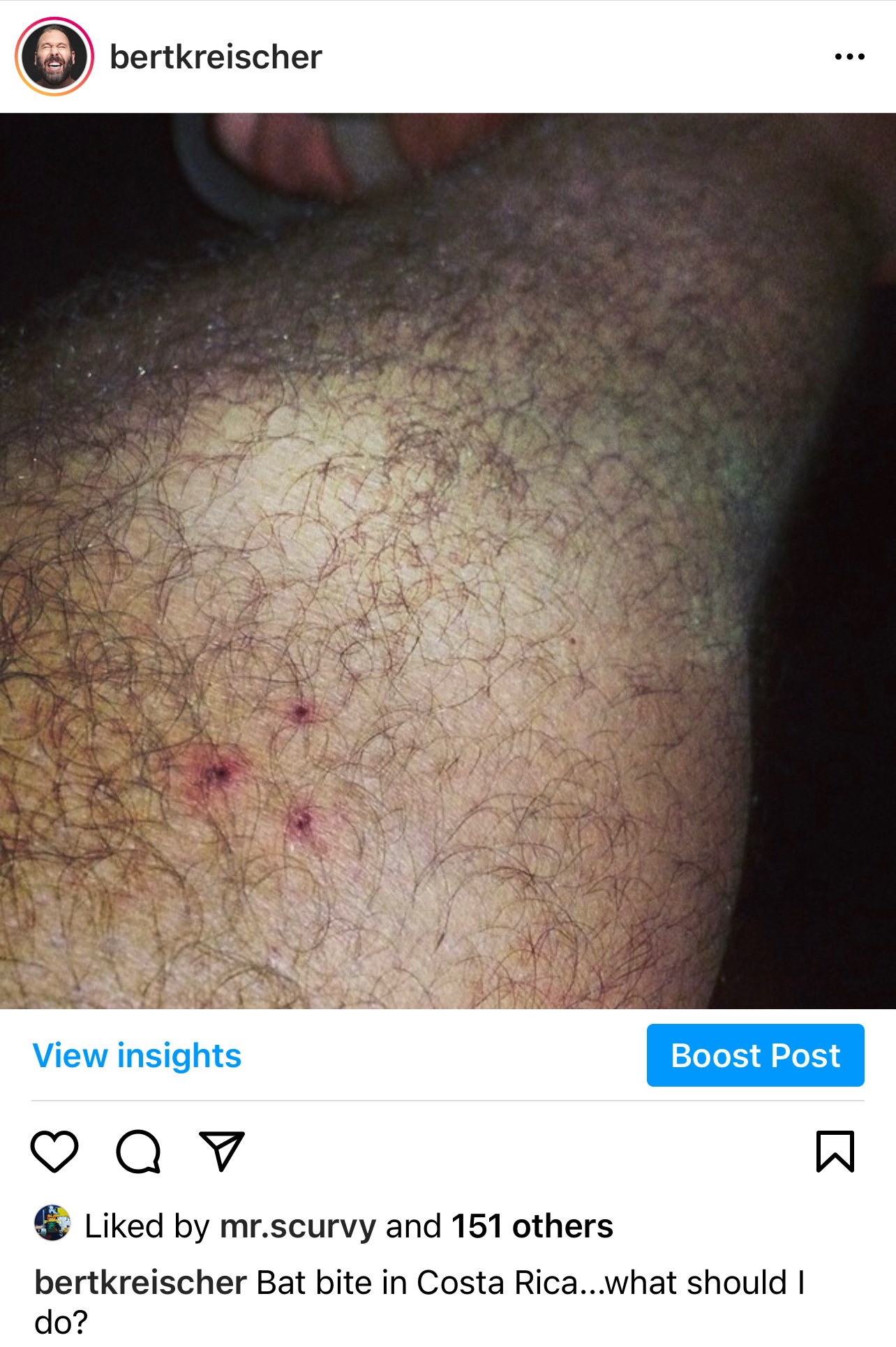 Bat Bite