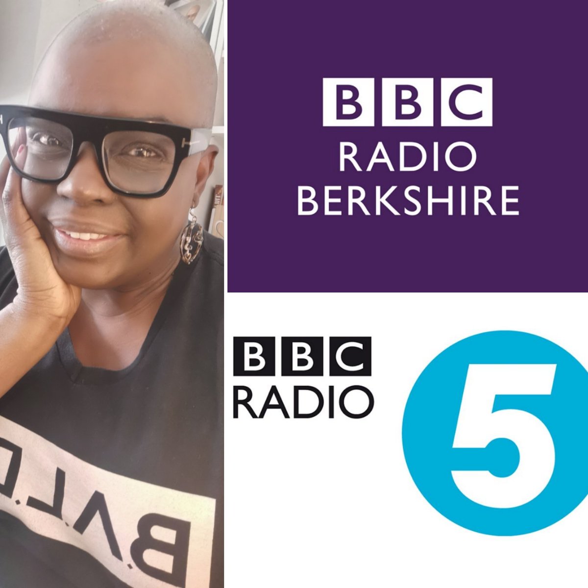 Alopecia is back trending in light of the Oscars last night. I was asked to do two radio interviews today to talk about the impact of Alopecia, an autoimmune condition that affects millions of people.
Thanks BBC Berkshire <a href="/BBCBerkshire/">BBC Berkshire</a> and BBC 5 Live <a href="/bbc5live/">BBC Radio 5 Live</a> for the invite 💙