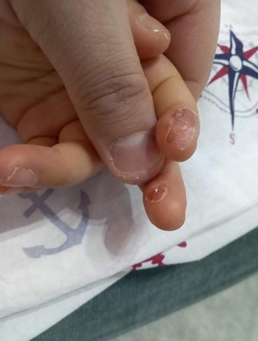 konuşan ellerimiz var bizim #parmağımdelinmesin 
<a href="/anadoludiyabet/">🇹🇷🇹🇷ANADOLUDİYABET🇹🇷🇹🇷ADANA</a>
<a href="/jsarieroglu/">Jülide Sarıeroğlu 🇹🇷</a>
<a href="/deryayanikashb/">Derya Yanık</a>
<a href="/aysekesir/">Ayşe Keşir 🇹🇷🇹🇷🇹🇷</a>
<a href="/RTErdogan/">Recep Tayyip Erdoğan</a>
<a href="/saglikbakanligi/">T.C. Sağlık Bakanlığı</a>
<a href="/HBTurkoglu/">Hacı Bayram TÜRKOĞLU</a>
<a href="/HMBakanligi/">T.C. Hazine ve Maliye Bakanlığı</a>
<a href="/csgbakanligi/">T.C. Çalışma ve Sosyal Güvenlik Bakanlığı</a>
<a href="/iyiparti/">İYİ Parti</a>
<a href="/MhpTbmmGrubu/">MHP TBMM Grubu #MHP</a>
<a href="/herkesicinCHP/">CHP 🇹🇷</a>