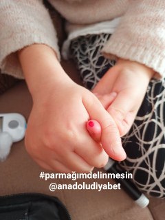 konuşan ellerimiz var bizim #parmağımdelinmesin 
<a href="/anadoludiyabet/">🇹🇷🇹🇷ANADOLUDİYABET🇹🇷🇹🇷ADANA</a>
<a href="/jsarieroglu/">Jülide Sarıeroğlu 🇹🇷</a>
<a href="/deryayanikashb/">Derya Yanık</a>
<a href="/aysekesir/">Ayşe Keşir 🇹🇷🇹🇷🇹🇷</a>
<a href="/RTErdogan/">Recep Tayyip Erdoğan</a>
<a href="/saglikbakanligi/">T.C. Sağlık Bakanlığı</a>
<a href="/HBTurkoglu/">Hacı Bayram TÜRKOĞLU</a>
<a href="/HMBakanligi/">T.C. Hazine ve Maliye Bakanlığı</a>
<a href="/csgbakanligi/">T.C. Çalışma ve Sosyal Güvenlik Bakanlığı</a>
<a href="/iyiparti/">İYİ Parti</a>
<a href="/MhpTbmmGrubu/">MHP TBMM Grubu #MHP</a>
<a href="/herkesicinCHP/">CHP 🇹🇷</a>