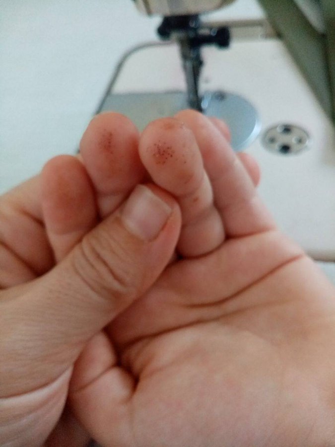 konuşan ellerimiz var bizim #parmağımdelinmesin 
<a href="/anadoludiyabet/">🇹🇷🇹🇷ANADOLUDİYABET🇹🇷🇹🇷ADANA</a>
<a href="/jsarieroglu/">Jülide Sarıeroğlu 🇹🇷</a>
<a href="/deryayanikashb/">Derya Yanık</a>
<a href="/aysekesir/">Ayşe Keşir 🇹🇷🇹🇷🇹🇷</a>
<a href="/RTErdogan/">Recep Tayyip Erdoğan</a>
<a href="/saglikbakanligi/">T.C. Sağlık Bakanlığı</a>
<a href="/HBTurkoglu/">Hacı Bayram TÜRKOĞLU</a>
<a href="/HMBakanligi/">T.C. Hazine ve Maliye Bakanlığı</a>
<a href="/csgbakanligi/">T.C. Çalışma ve Sosyal Güvenlik Bakanlığı</a>
<a href="/iyiparti/">İYİ Parti</a>
<a href="/MhpTbmmGrubu/">MHP TBMM Grubu #MHP</a>
<a href="/herkesicinCHP/">CHP 🇹🇷</a>