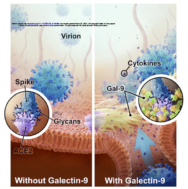 MikeSheikh2's tweet photo. Preprint shows destructive power of #Galectin9. Clear target of #SARSCoV2 & prognosticator of severe #COVID19. https://t.co/0gz5m7GDvc Love summary - Manipulation of Gal-9 should be explored as a therapeutic strategy. Another call for a #galectininhibitor (Sigamani et al) https://t.co/H2BwsNy0dy